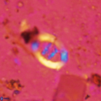 Gorkaea operio VR 15936