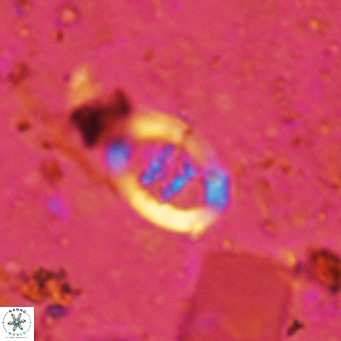 Gorkaea operio VR 15936