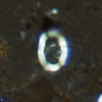 Gorkaea operio VR 15937