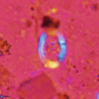 Gorkaea operio VR 15938