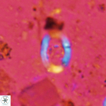 Gorkaea operio VR 15938