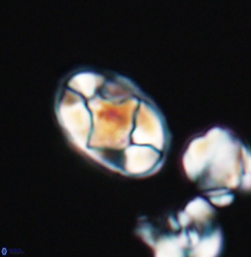 Gorkaea adamas brevis 11346