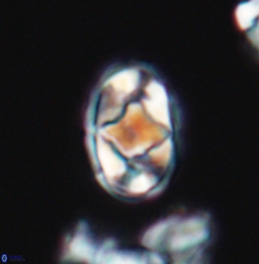 Gorkaea adamas brevis 11349