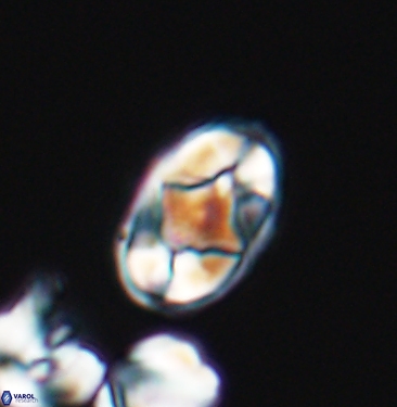 Gorkaea adamas brevis 11351