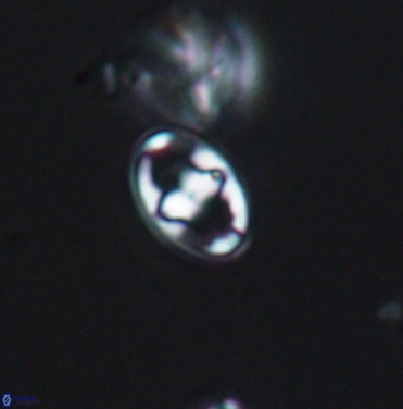 Gorkaea exiguus 11419