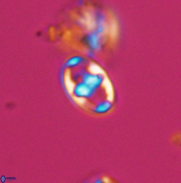 Gorkaea exiguus 11420