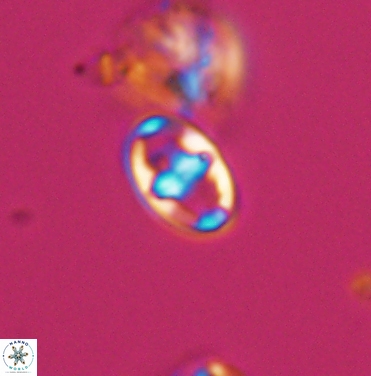 Gorkaea exiguus 11420