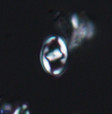 Gorkaea exiguus 11421