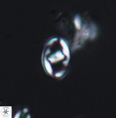 Gorkaea exiguus 11421
