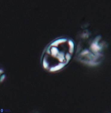 Gorkaea exiguus 11423