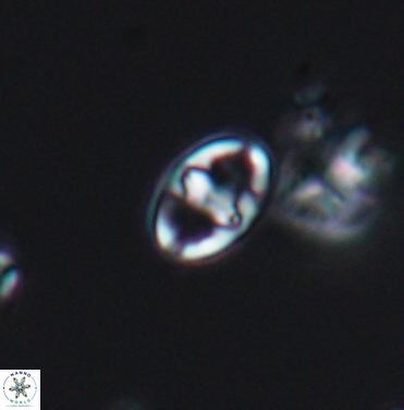 Gorkaea exiguus 11423