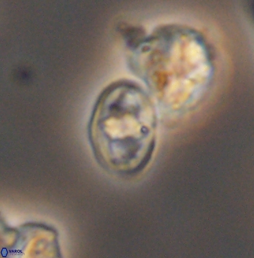 Gorkaea exiguus 11425