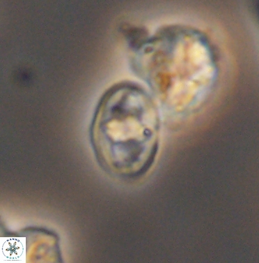 Gorkaea exiguus 11425