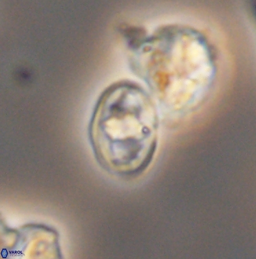 Gorkaea exiguus 11426