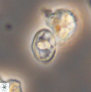 Gorkaea exiguus 11426