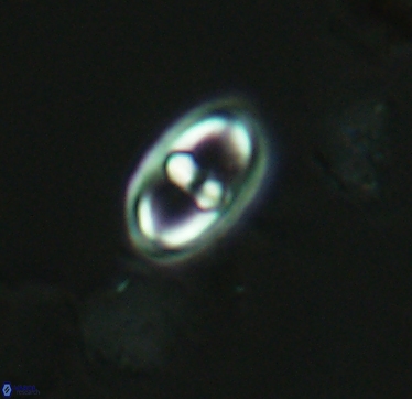 Gorkaea exiguus 2956