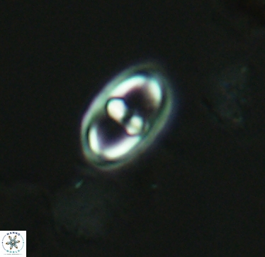 Gorkaea exiguus 2956