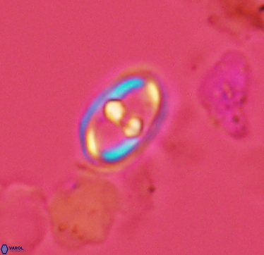 Gorkaea exiguus 2957