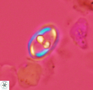 Gorkaea exiguus 2957