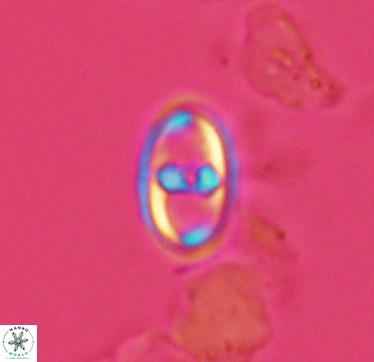 Gorkaea exiguus 2958