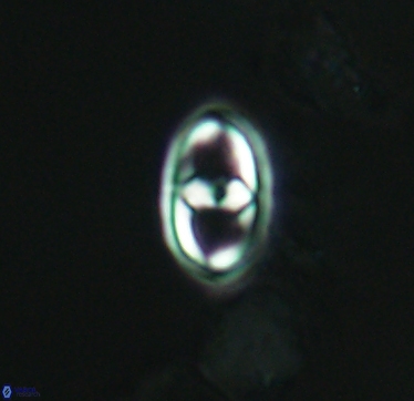 Gorkaea exiguus 2959