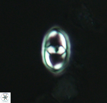 Gorkaea exiguus 2959