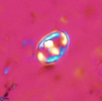 Gorkaea exiguus 48691