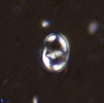 Gorkaea exiguus 48692