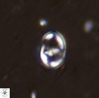 Gorkaea exiguus 48692