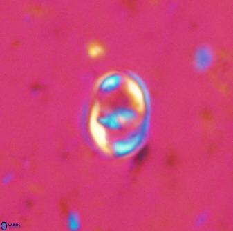 Gorkaea exiguus 48693
