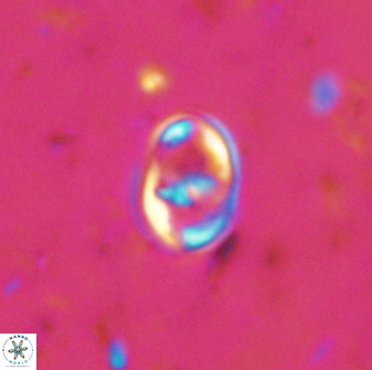 Gorkaea exiguus 48693