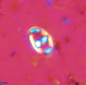 Gorkaea exiguus 48694