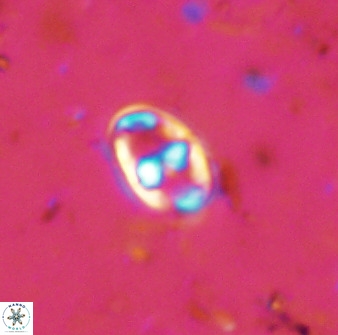 Gorkaea exiguus 48694