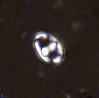 Gorkaea exiguus 48695