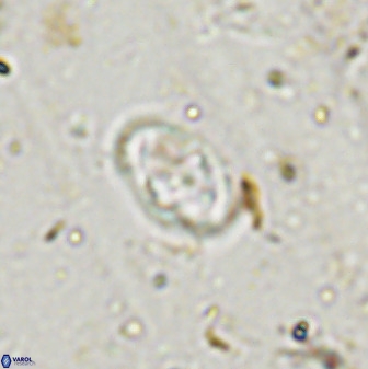 Gorkaea exiguus 48696