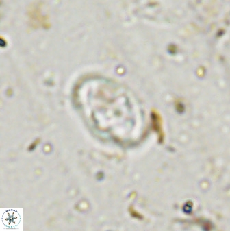 Gorkaea exiguus 48696