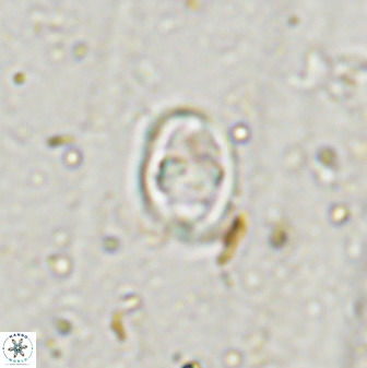 Gorkaea exiguus 48697