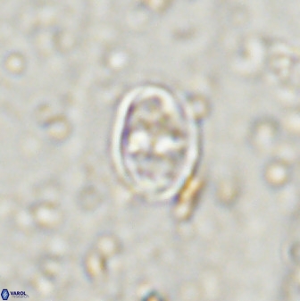 Gorkaea exiguus 48698