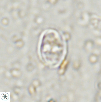 Gorkaea exiguus 48698