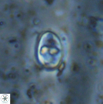 Gorkaea exiguus 48699