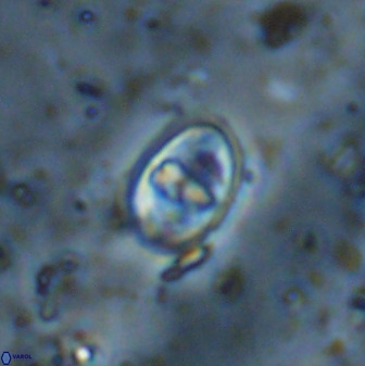 Gorkaea exiguus 48700