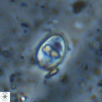 Gorkaea exiguus 48700