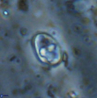 Gorkaea exiguus 48701