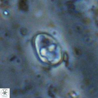 Gorkaea exiguus 48701