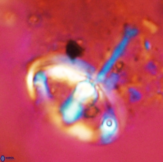 Gorkaea pomerolii 42386