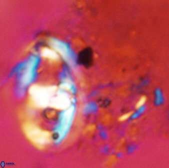 Gorkaea pomerolii 42387