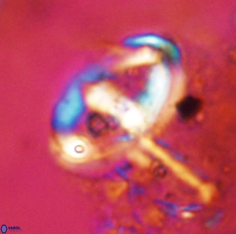 Gorkaea pomerolii 42390