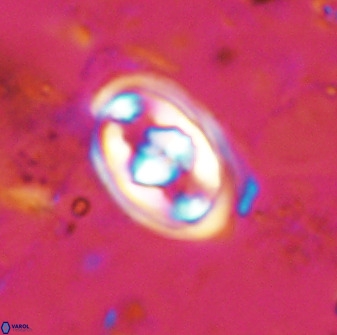 Gorkaea pomerolii 48000
