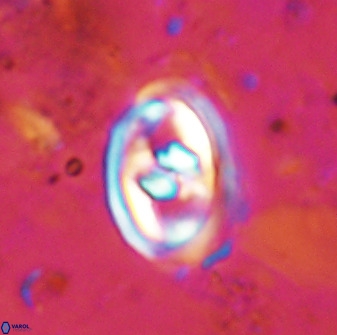 Gorkaea pomerolii 48001