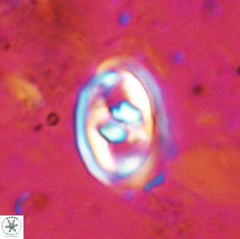 Gorkaea pomerolii 48001